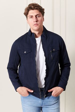 Fermuarlı Erkek Keten Mont